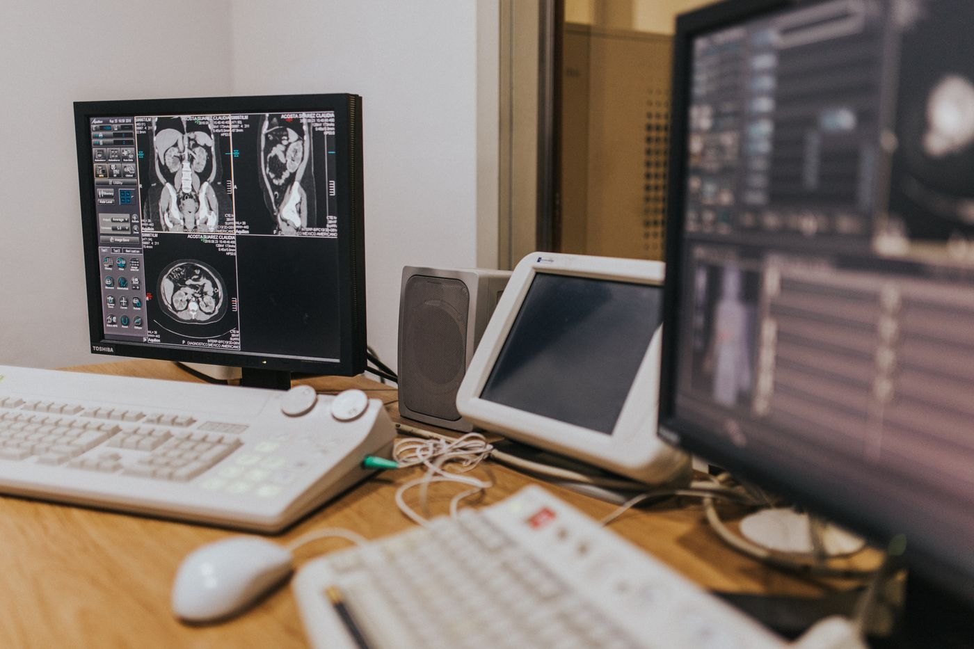 A reading room with medical imaging studies displayed across several monitors.